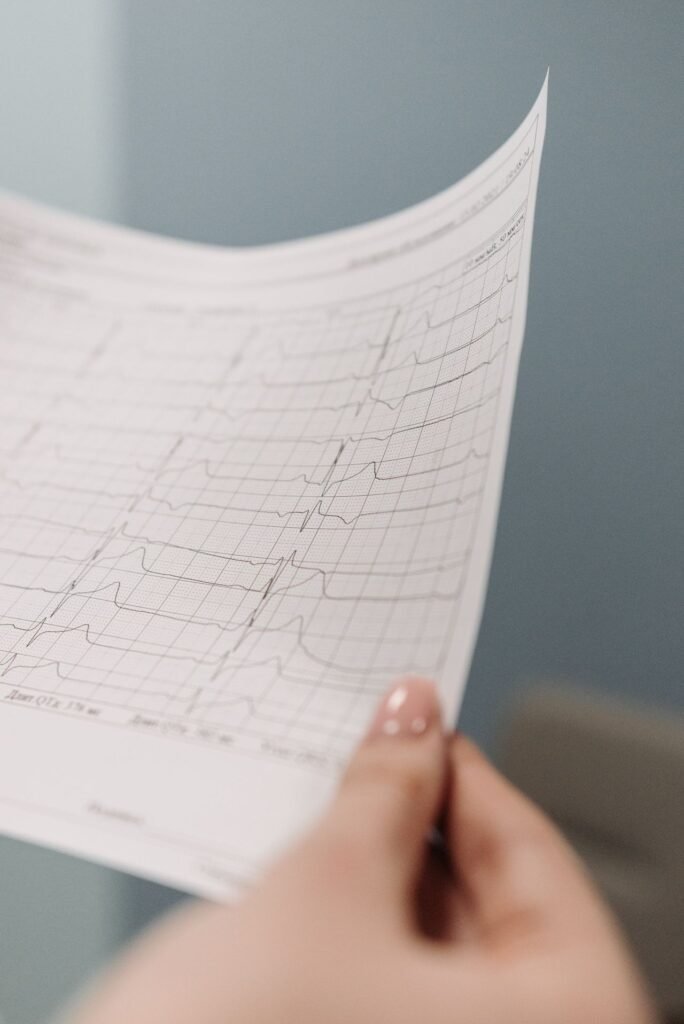Résultat ECG - Mediclin Germany